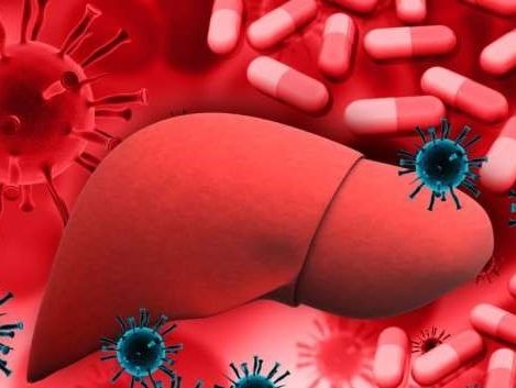 7 nguyên nhân gây xơ gan không do rượu