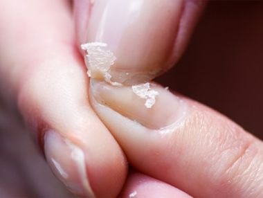 Những biểu hiện thiếu canxi bạn cần lưu ý