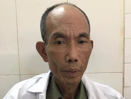 Cảnh sát vào cuộc vụ thương binh bị hành hung sau va chạm giao thông