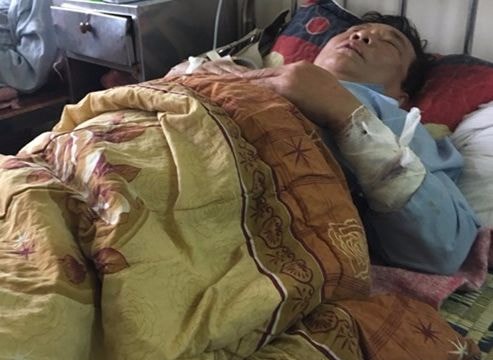 Trạm trưởng trạm y tế bị chồng nhân viên chém trọng thương