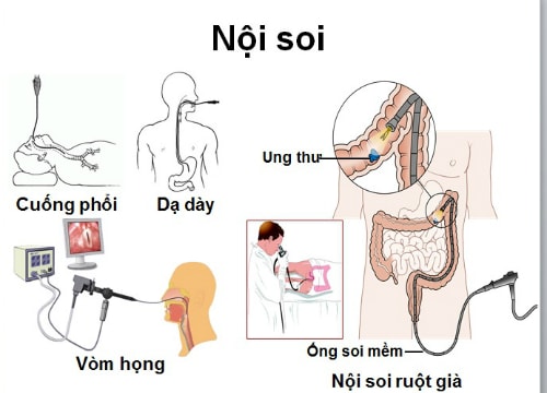 Những tiến bộ và thành tựu trong chữa trị ung thư