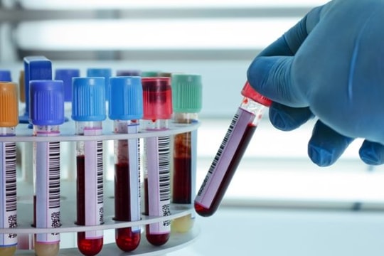 6 xét nghiệm giúp phát hiện sớm ung thư