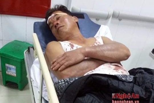 Can ngăn nhóm thanh niên đánh nhau, công an viên bị rách đầu