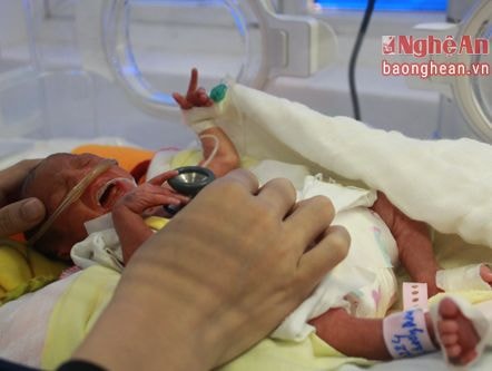 Nghệ An: Bé gái sinh non 800 gam nguyên bọc ối cực hiếm gặp