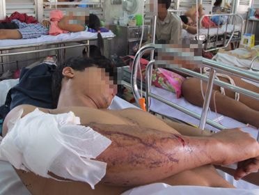 Trưởng công an thị trấn bị đâm nhập viện