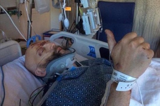 Diễn viên Harry Potter bị gãy cổ, thủng phổi sau tai nạn ô tô kinh hoàng