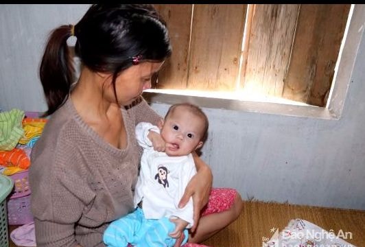 Mẹ đơn thân nuôi con nhỏ bị bệnh tim bẩm sinh