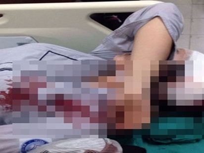 Công an triệu tập hai nghi can đánh nữ sinh nhập viện