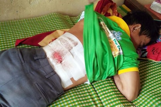 Dùng dao đâm trọng thương hàng xóm