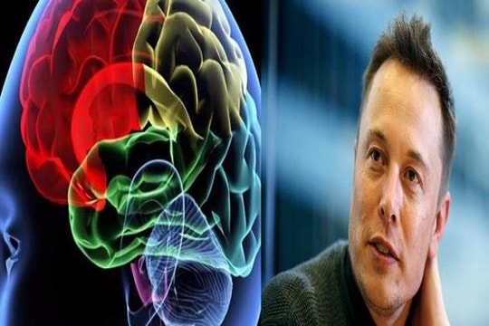 Thiết bị giúp vỏ não người kết nối với máy tính