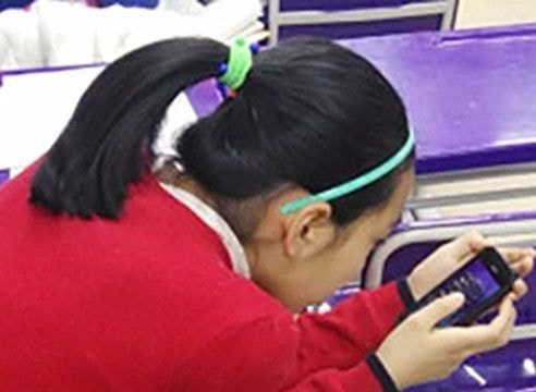 Cô bé hỏng cổ vĩnh viễn vì thói quen 'cắm mặt' vào điện thoại