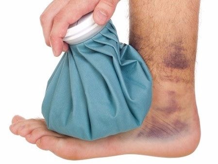 Làm vết bầm tan trong nháy mắt nhờ trứng luộc