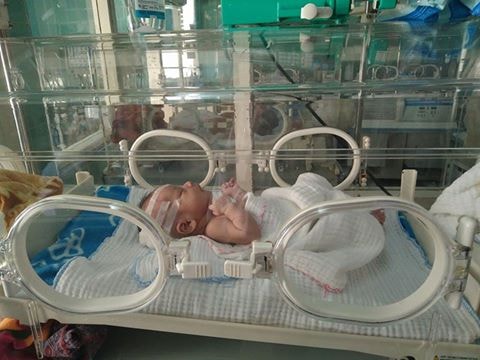 Sản phụ tự đẻ kéo đầu con đến vỡ xương sọ