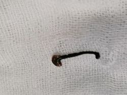 Uống nước khe suối, nhập viện khẩn cấp vì bị vắt chui vào mũi