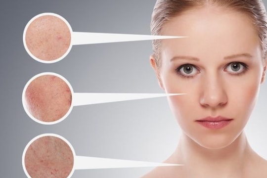 Nhận biết và chữa trị các bệnh về da thường gặp trong mùa hè