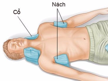 Xử trí khi có người say nắng ngất xỉu
