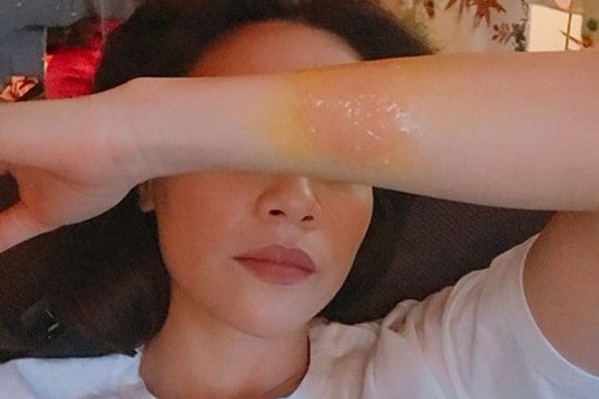 Bỏng tay, Hồ Ngọc Hà cầu cứu dân mạng