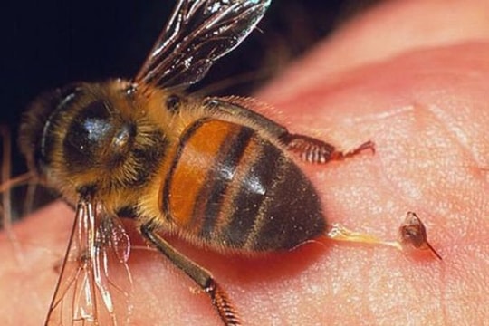 Cách xử lý khi bị ong độc đốt