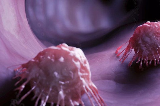 'Tàu ngầm siêu nhỏ' mang thuốc diệt tế bào ung thư