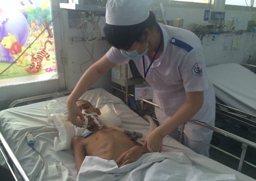 Dấu hiệu phân biệt viêm não với viêm màng não