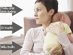 Trầm cảm sau sinh - Dấu hiệu, nguyên nhân và cách phòng bệnh