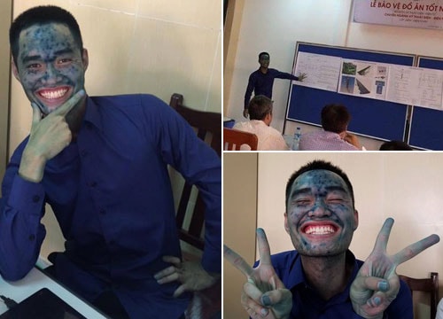 Nam sinh bị thủy đậu xanh mặt vẫn bảo vệ đồ án tốt nghiệp