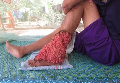 Thiếu nữ mắc bệnh lạ 'nở hoa' xin được hiến tạng cứu người