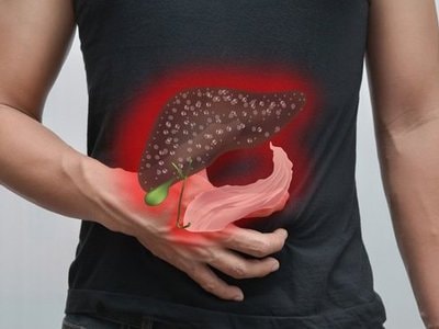 Lý do bất ngờ khiến người trẻ bị gan nhiễm mỡ