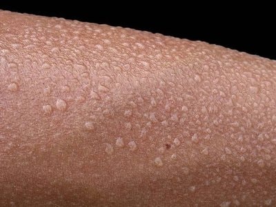 Miếng dán biến mồ hôi thành nguồn sạc cho điện thoại