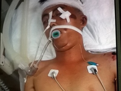 Tìm người nhà nam thanh niên đi nhờ xe bị chấn thương sọ não