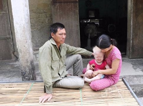 Hoàn cảnh éo le của gia đình cháu bé mắc bệnh bạch tạng bẩm sinh