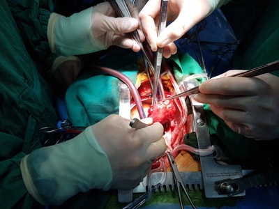 Nghệ An phẫu thuật thành công khối u lớn trong tim