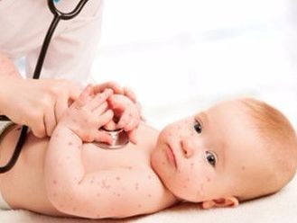 Những bệnh phổ biến và nguy hiểm trẻ dễ mắc vào mùa nóng