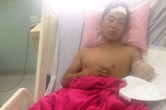 Truy tìm kẻ cán nát tay bí thư chi đoàn rồi bỏ trốn