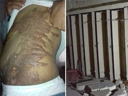 Nạn cưỡng hiếp và tra tấn rùng rợn trong nhà tù IS