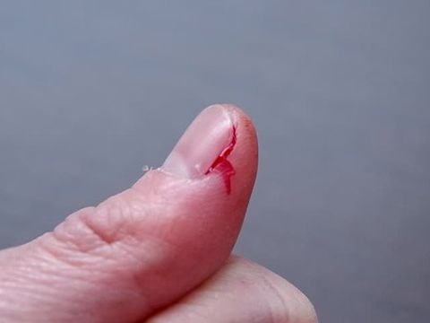 Nước bọt giúp làm lành vết thương