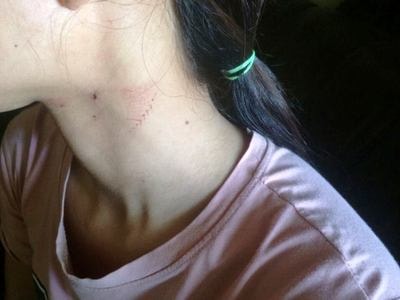 Người dân bị đánh, Công an không khởi tố nhưng Viện kiểm sát lại khởi tố