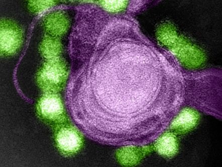 Virus Zika tiêu diệt tế bào ung thư não