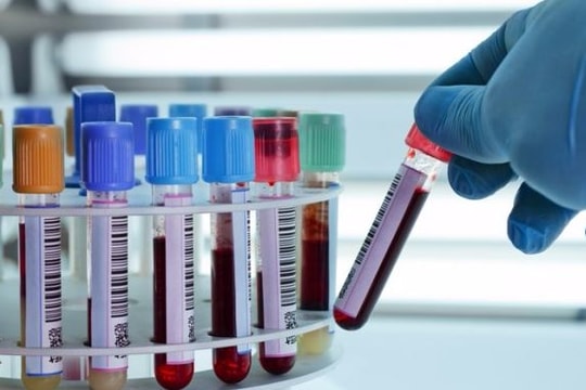 Sẽ có 15.000 người được khám sàng lọc ung thư miễn phí