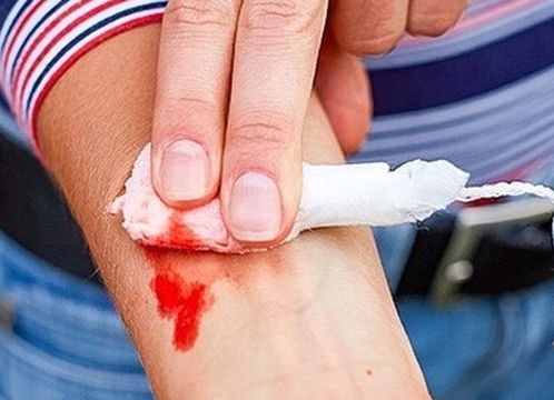 10 bí kíp sinh tồn giúp bạn thoát nạn trong gang tấc