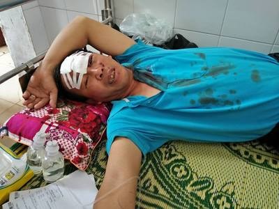 4 người bị thương nặng trong vụ 2 xe buýt Đông Bắc đâm nhau