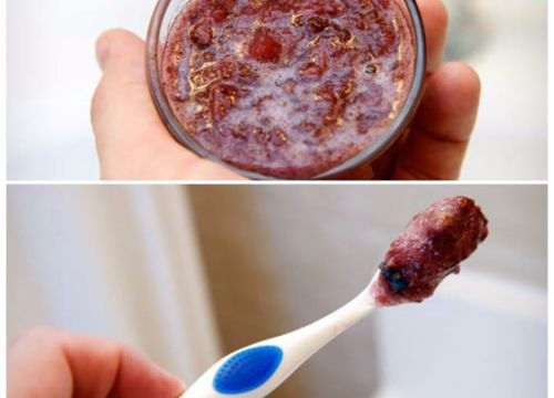 9 lời khuyên cho một nụ cười hoàn hảo như sao Hollywood