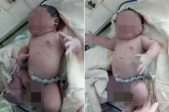 Kỷ lục Việt Nam: Bé sơ sinh nặng 7,1 kg