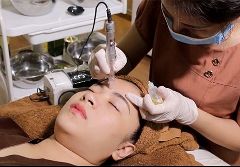 Trẻ hóa da mặt bằng PRP tại Korea Beauty Medi Spa