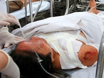 Cụ ông tạt axít người tình kém 22 tuổi vì ghen