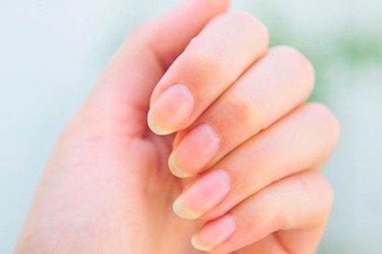 Đánh tan móng tay bị ố vàng chỉ với những cách này
