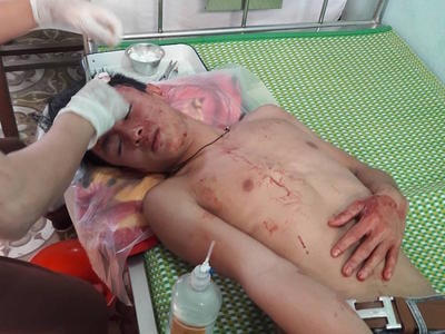 Nghệ An: Vào trường học đánh thầy giáo, học sinh nhập viện