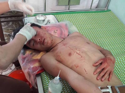 Khởi tố, tạm giam 3 đối tượng đánh thầy giáo, học sinh nhập viện