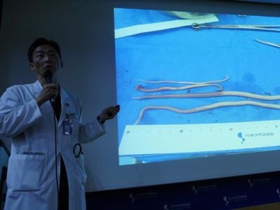 Giun sán ký sinh có thể đang hoành hành ở Triều Tiên