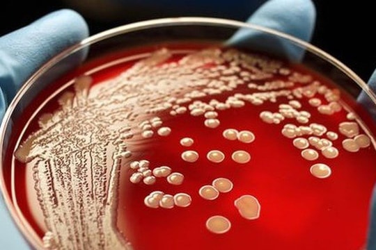 Siêu vi khuẩn kháng thuốc xuất hiện nhiều ở bệnh viện là loại nào?